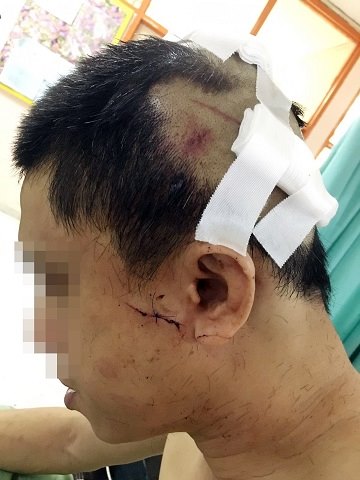 Singaporean chef, 44, in hospital in Malaysia after being beaten by 3 men with baseball bats, SE Asia News & Top Stories