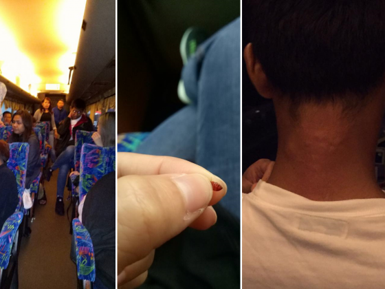 Passengers on board KL-Singapore bus bitten by bed bugs