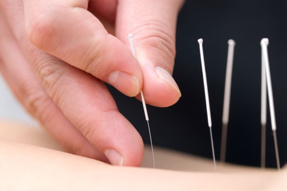 ‘Flesh-eating infection’ after acupuncture for back sprain costs Hong Kong man his leg