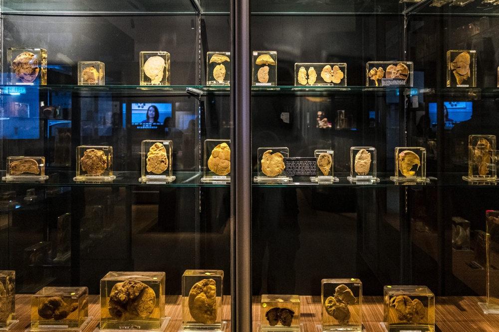 Universiti Malaya opens public access to one of Asia’s most unique medical collections