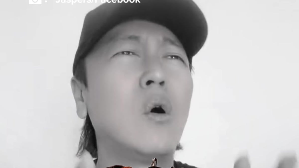 He was in so much pain that he thought he had shingles. sg