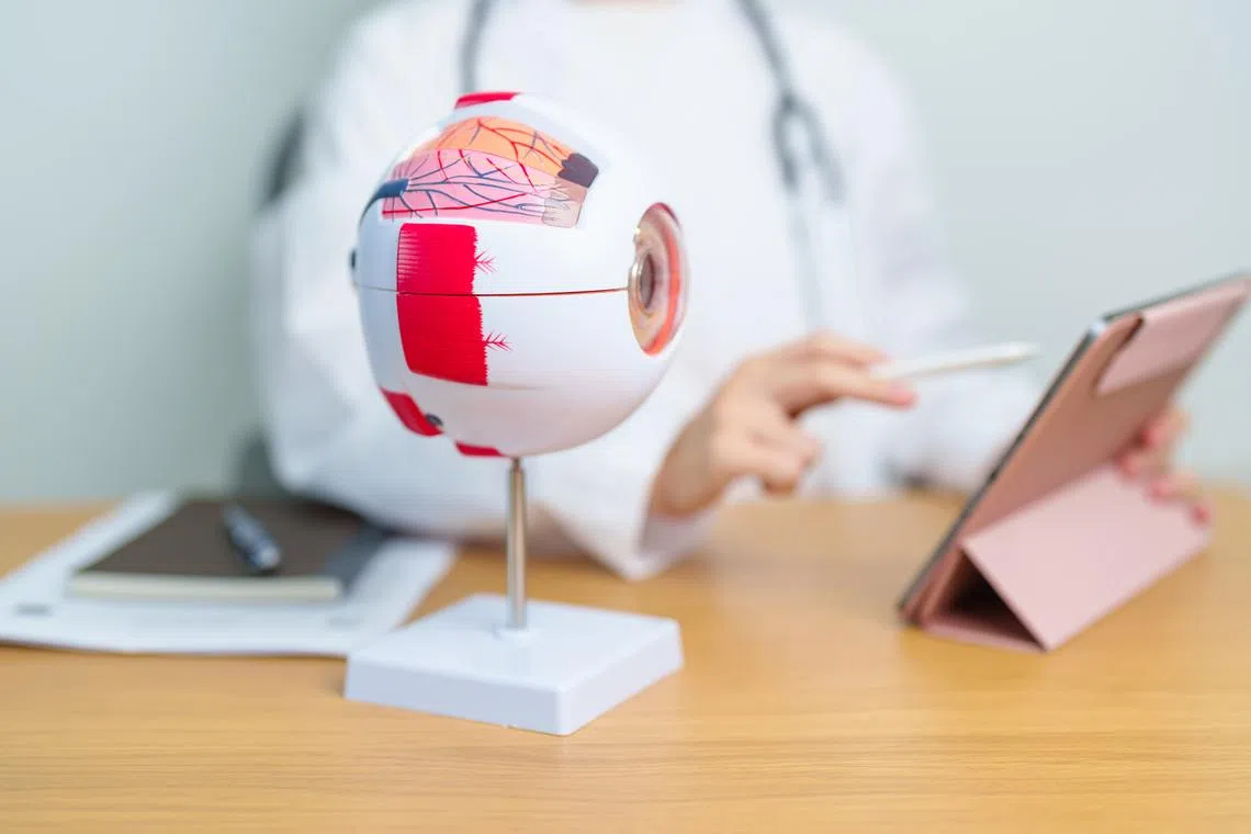 MIGS explained: The minimally invasive glaucoma surgery that could end daily eye drops